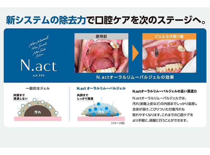口腔ケア製品「N.act（エヌ.アクト）オーラルリムーバルジェル」の除去力を示す比較画像。「新システムの除去力で口腔ケアを次のステージへ。」というキャッチコピーと共に、使用前とジェル拭き取り後の口腔内の比較写真を掲載。一般的なジェルは汚れの内部まで浸透しないのに対し、N.actは内部までしっかり浸透して汚れを浮かせ、こびりついた付着汚れも取れやすくすることを図解で説明しています。